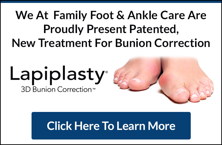 lapiplasty banner