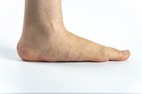 Flat Feet Do Not Limit Young Athletes