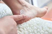 Cracked Heels Treatment