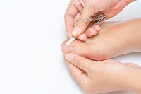 Trim Properly to Avoid Ingrown Toenails