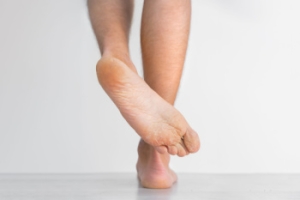Understanding Tinea Pedis